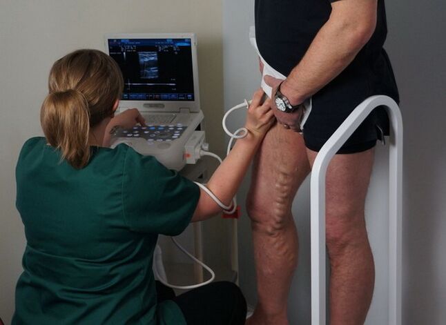 pregled ven pred lasersko koagulacijo za krčne žile